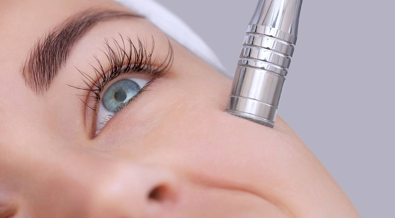 Mikrodermabrasion